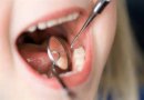 ¿Eso de ahí es una caries?: Cómo es la salud dental de los chilenos