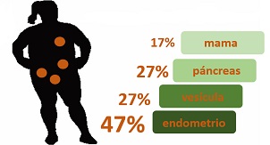 Obesidad femenina y cáncer