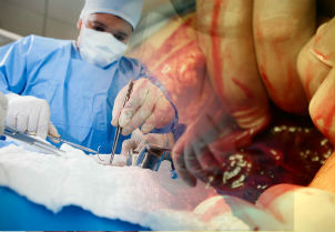 OMS establece 29 directrices de detener las infecciones quirúrgicas