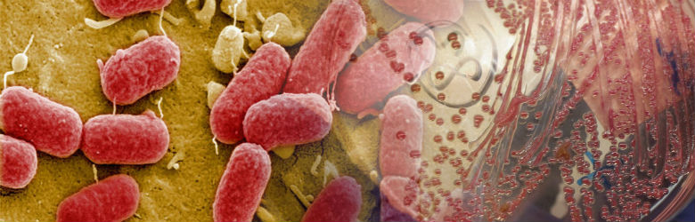 OMS publica lista de bacterias para las que se necesitan "urgentemente nuevos antibióticos"
