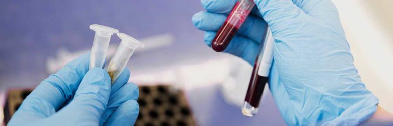 Nuevo análisis de sangre podría detectar más de 50 tipos de cáncer