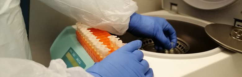 Salud autoriza examen PCR sin prescripción médica