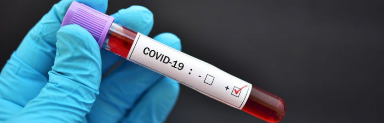 Chile registra más de 2 millones de casos de COVID-19 desde el inicio de la pandemia